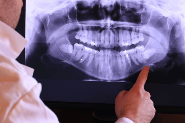 Best Emergency Care for Gum Disease in Cedar Ridge, CA