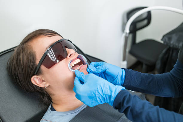 Best Knocked-Out Tooth (Avulsed Tooth) Treatment in Cedar Ridge, CA